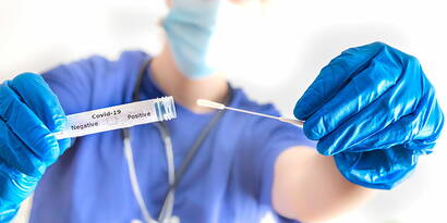 Kostenübernahme Coronatest durch den Bund Coronavirus Update: Information zur Kostenübernahme des Bundes betreffend der Coronatests (Rachenabstrich und serologischer Test), der nationalen Maskenpflicht ab dem 6. Juni 2020 im öffentlichen Verkehr sowie zur SwissCovid App und Contact Tracing inklusive Downloadlinks für Android und iPhone.