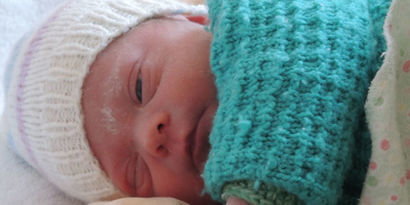 Trisomie 21 Trisomie 21