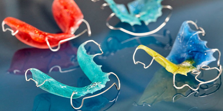 Appareils d'expansion Comme son nom l'indique, les Appareils d’expansion sert à étirer la mâchoire et offre plus d'espace pour les dents. Le temps de traitement pour une prolongation est d'environ 1 à 2 ans. Avec cette méthode, il n'est pas possible de corriger la position finale de la dent. Il sert de préparation pour une utilisation ultérieure des crochets.